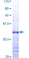 12.5% SDS-PAGE Stained with Coomassie Blue.